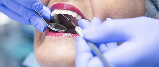 Best Emergency Root Canal Treatment in Missouri City, TX